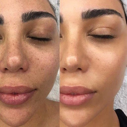 BeautyTheSense™ GlowPulse Facial Tool
