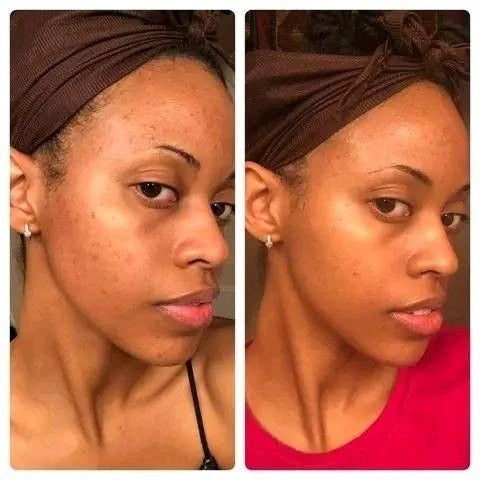 BeautyTheSense™ GlowPulse Facial Tool