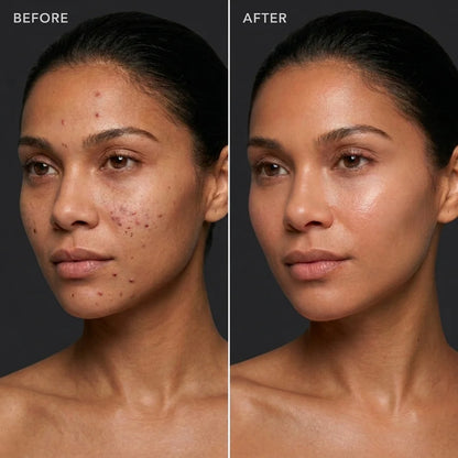 BeautyTheSense™ GlowPulse Facial Tool